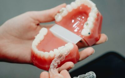 Can Invisalign Fix Overbite? Exploring Effective Orthodontic Solutions