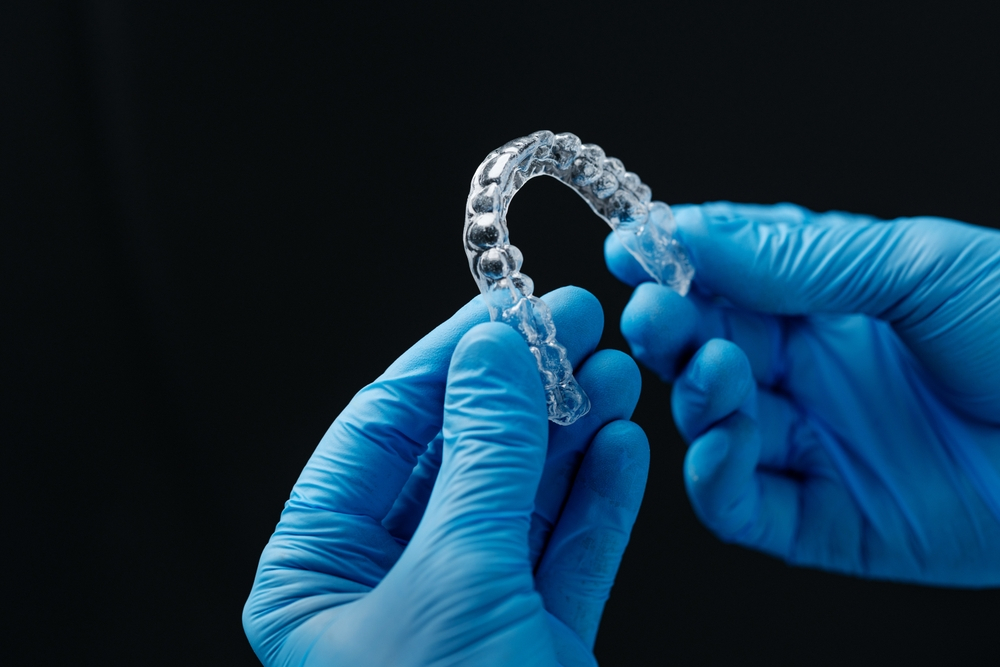 Invisalign Buttons: The Tiny Tools That Make a Big Difference in Teeth Alignment
