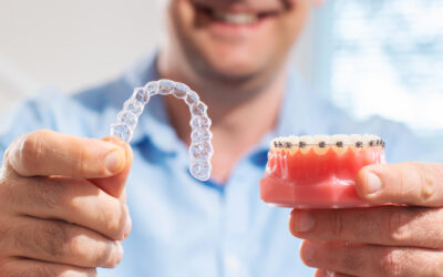 Is Invisalign Faster Than Braces?