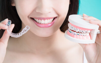 Can You Get Braces With a Crown?